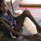 A young boy who is suffering from a severe leg infection that will not heal. Kate Holt.