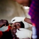 50 year old Seteiya Makoi has her bandages removed by Lester Moitai, a trachoma monitor. Kate Holt.