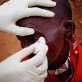 Mooltetiein Salaash, 65 years old, has her bandages removed by Lester Moitai, a trachoma monitor. Kate Holt.