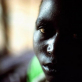 Portrait of a young girl in a female ward of Bukavu Hospital. Kate Holt.