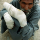 A man sits beside the road in Nazariyah. Both his hands were caught in an explosion when his house was bombed. Kate Holt.