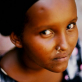 A beneficiary of Johanniters health projects in Deble Village, Djibouti. Kate Holt.